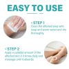 Picture of Antifungal Cream, Athletes Foot Treat-ment Cream, Antifungal Treat-ment for Athletes Foot, 2FL.OZ